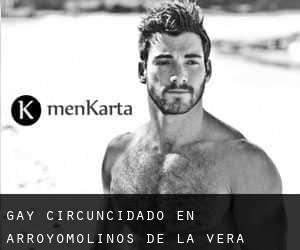 Gay Circuncidado en Arroyomolinos de la Vera
