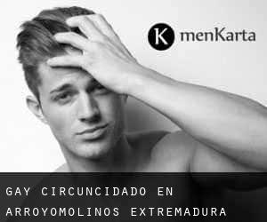 Gay Circuncidado en Arroyomolinos (Extremadura)